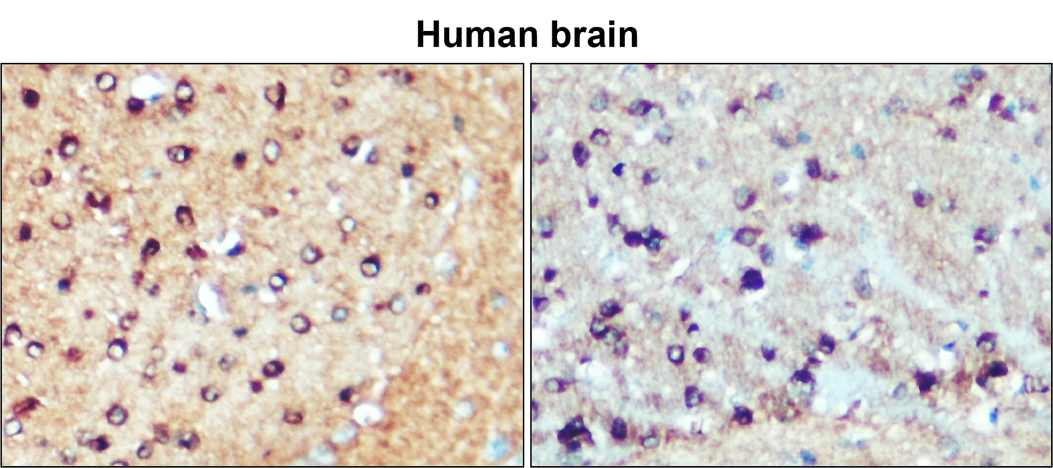 Tau Antibody