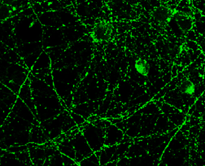 Tau Antibody