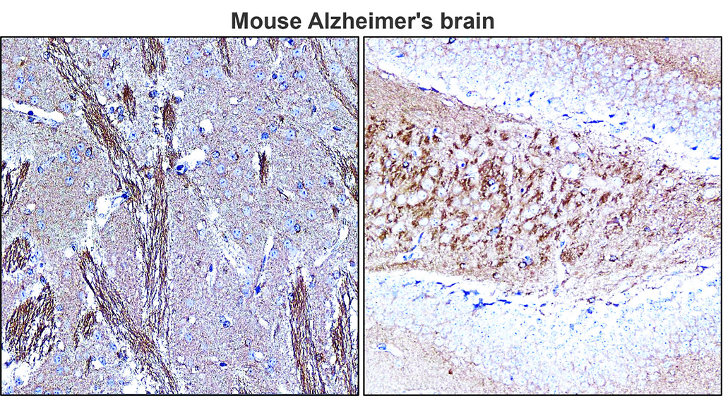 Tau Antibody