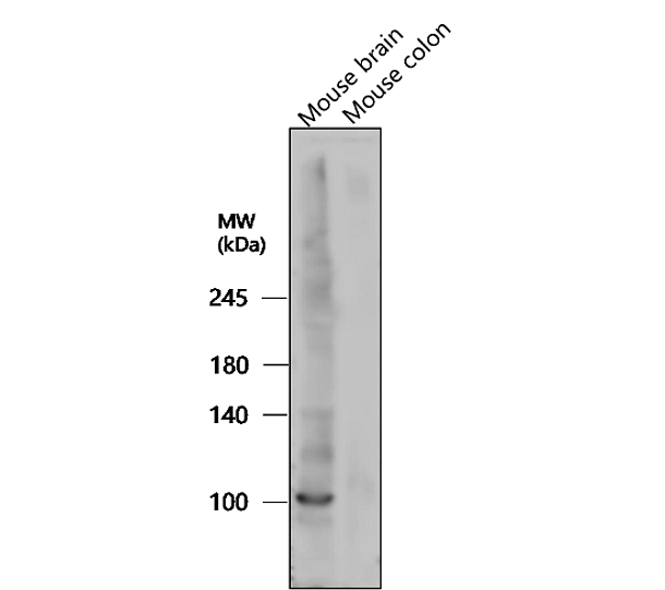 LRRK2 Antibody