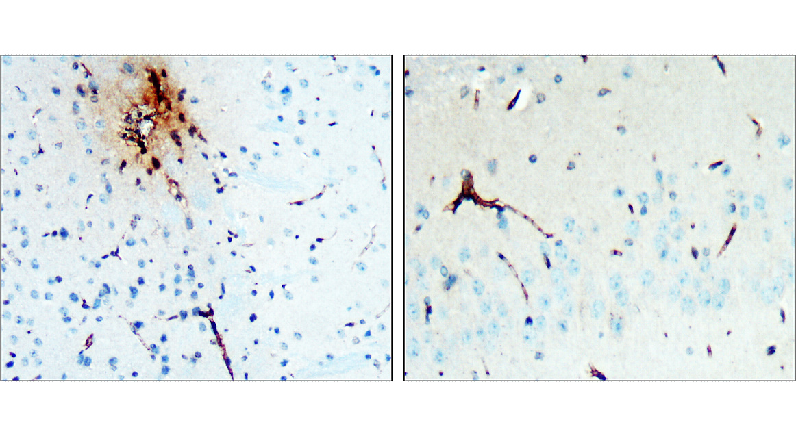 LRRK2 Antibody