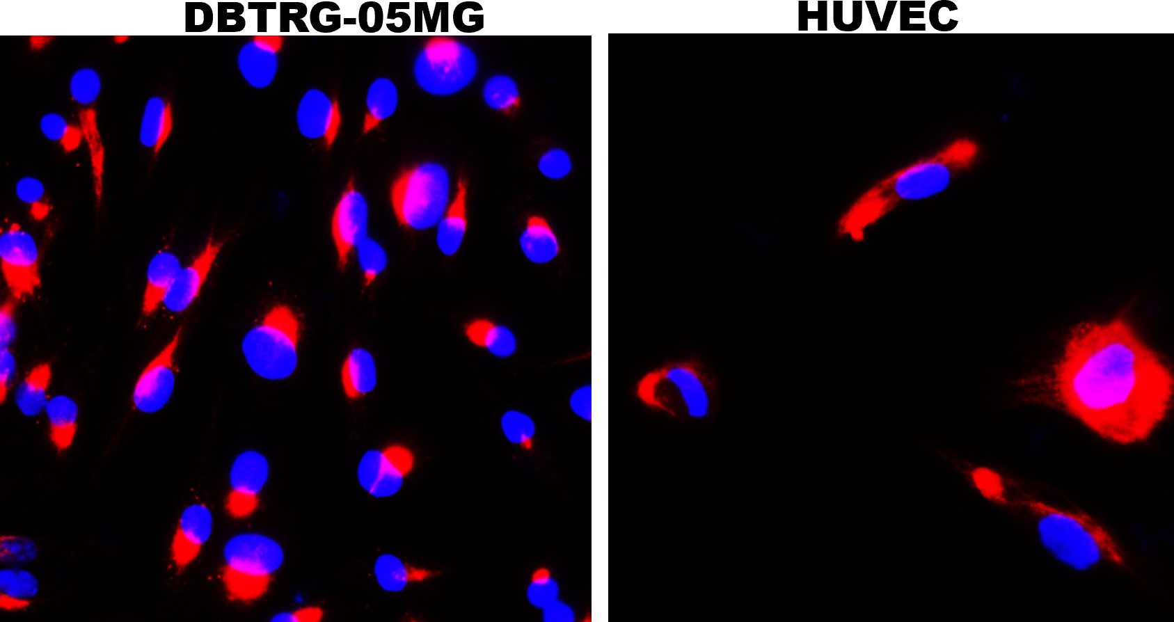 LRRK2 Antibody