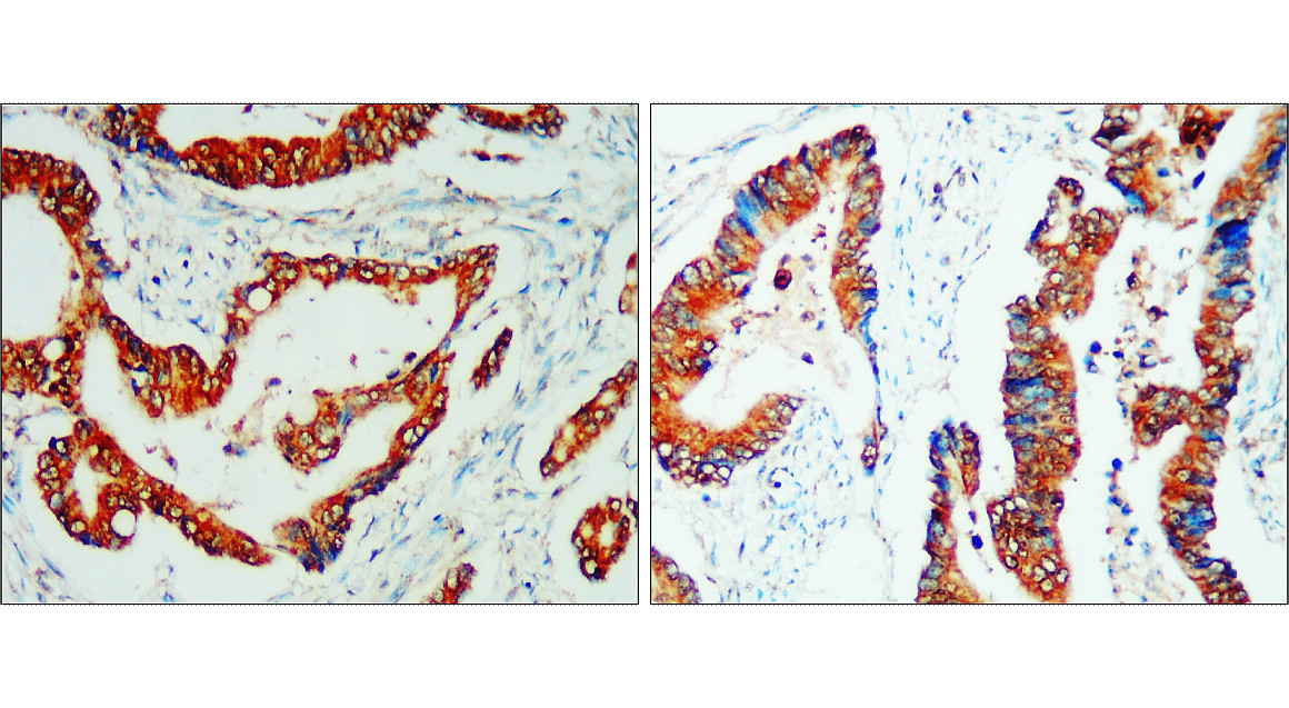 CD133 antibody