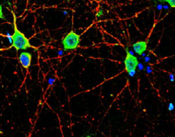 Neurofilament L antibody