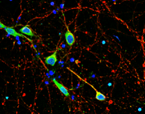 Neurofilament L antibody