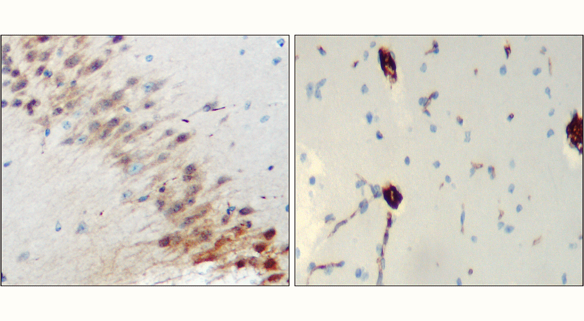 Neurofilament L antibody