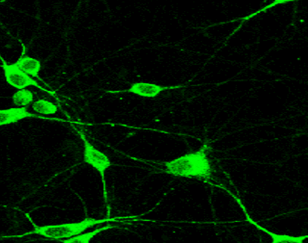 Neurofilament H / NF H