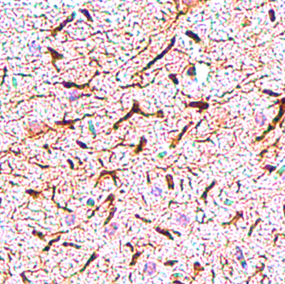 Neurofilament H antibody