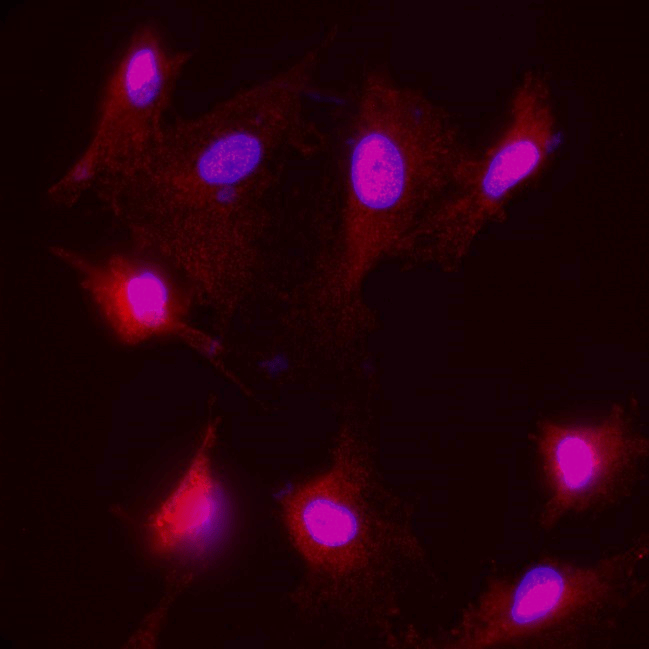 Neurofilament H antibody