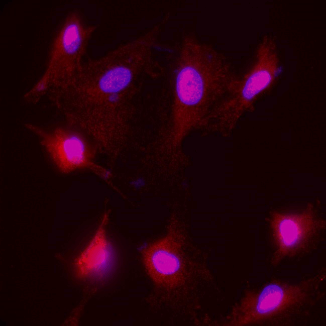 Neurofilament H / NF H