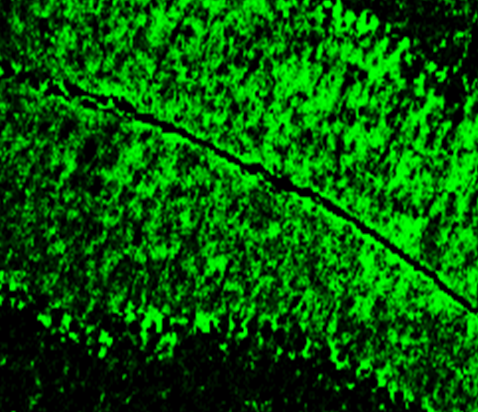 Neurofilament H antibody