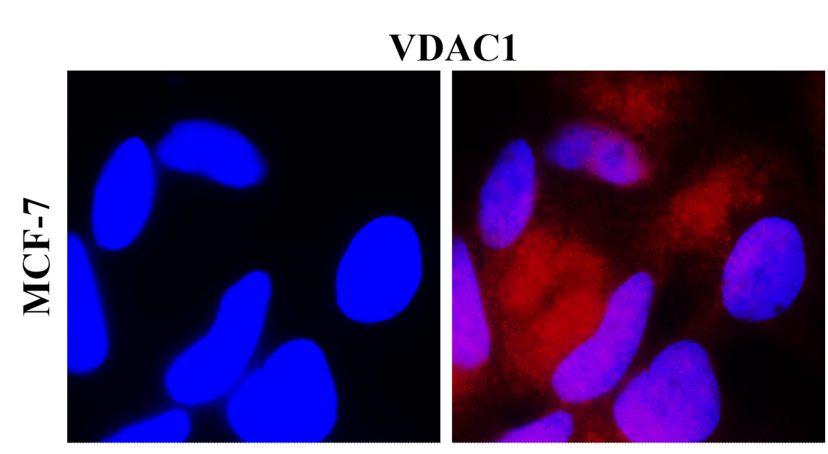 VDAC1/Porin Antibody