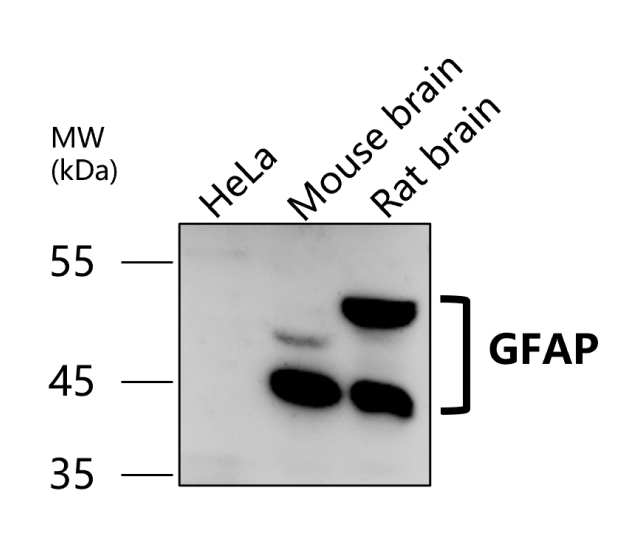 GFAP Antibody