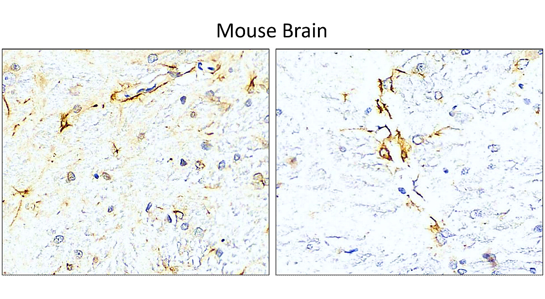 GFAP Antibody