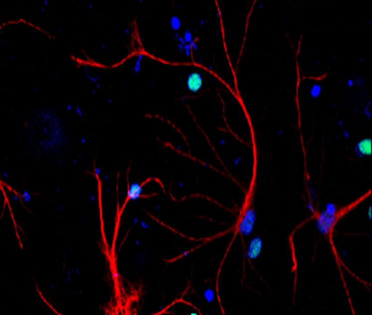 GFAP Antibody