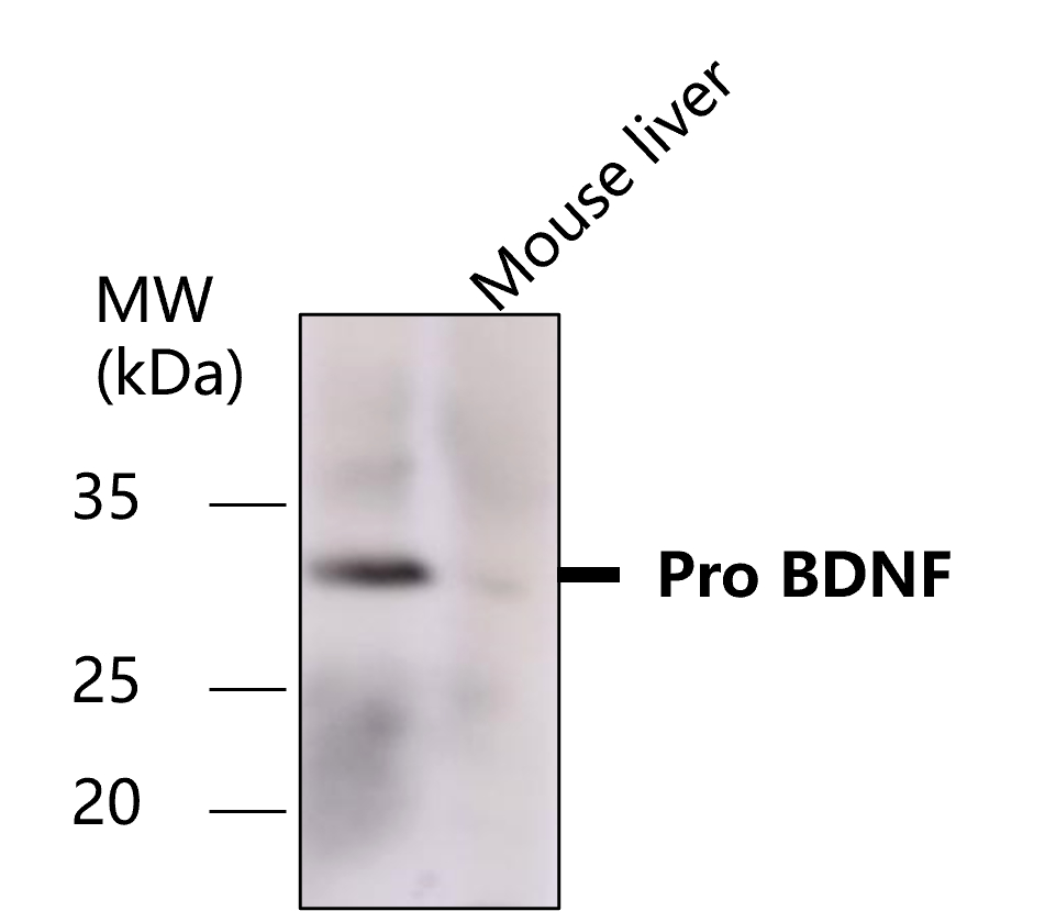 BDNF