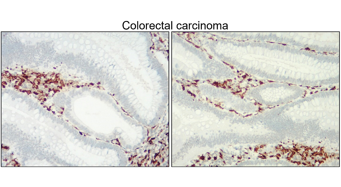 Iba1 antibody