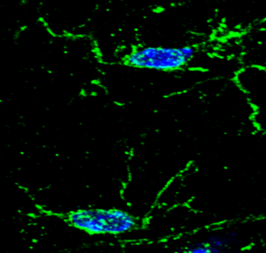 Iba1 antibody