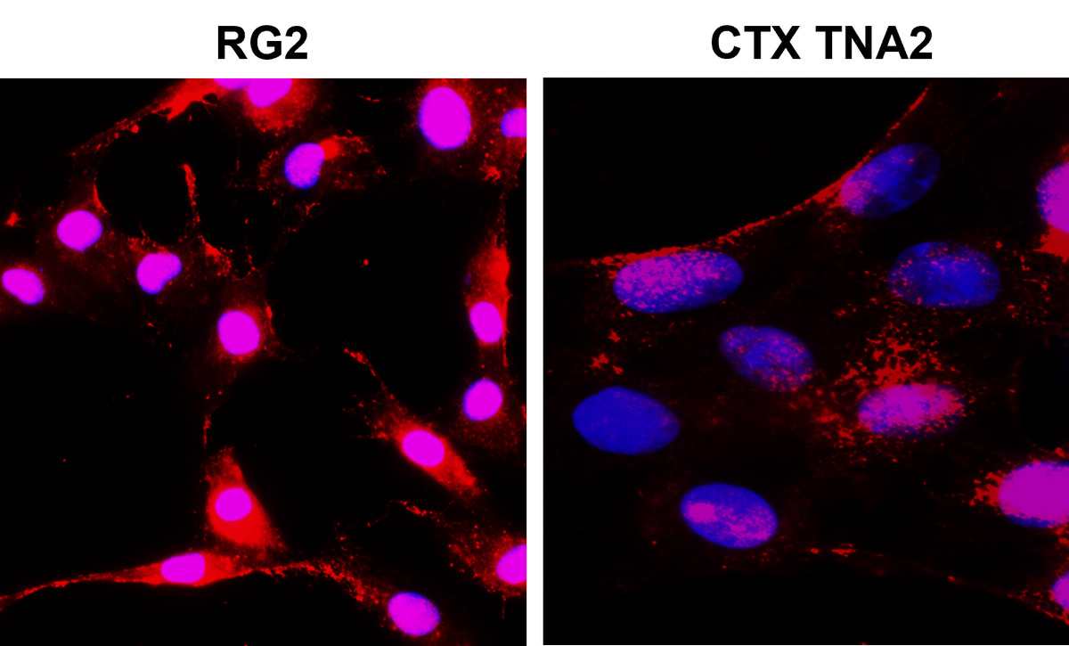 NOTCH1 Antibody