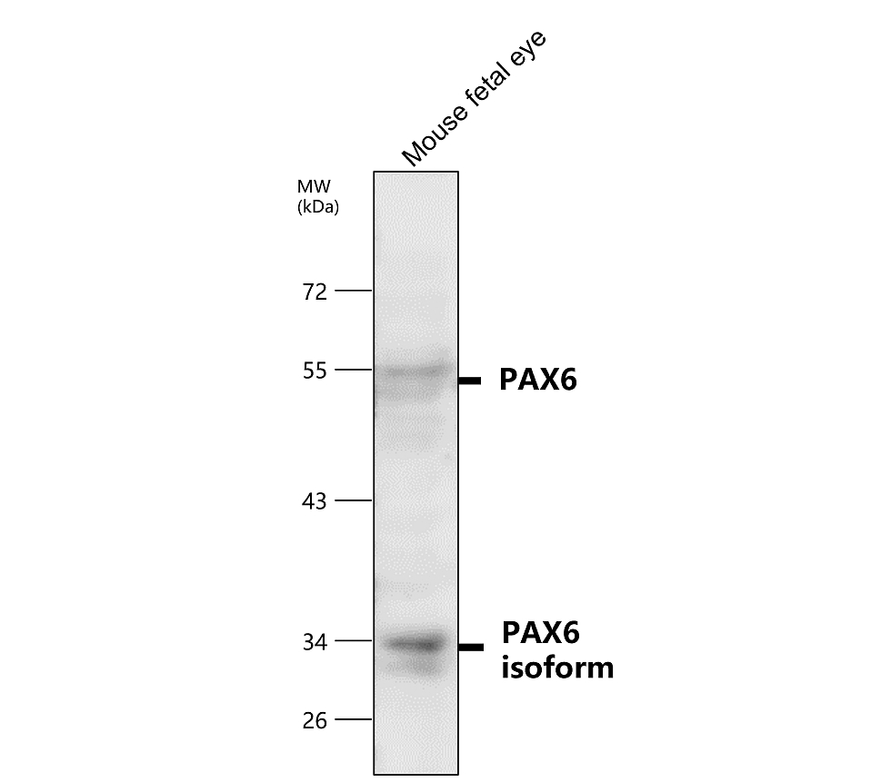 PAX6