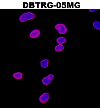 Lamin B1 Antibody
