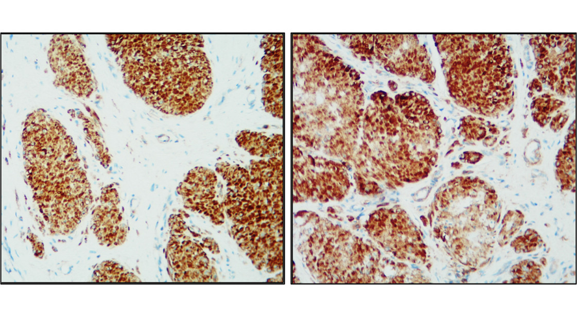 Beta-actin Antibody