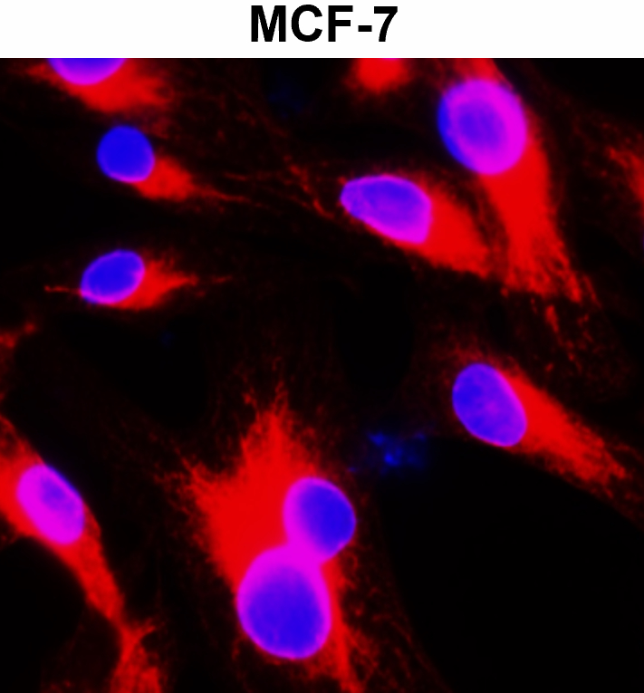 Beta-actin