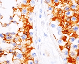 Vinculin