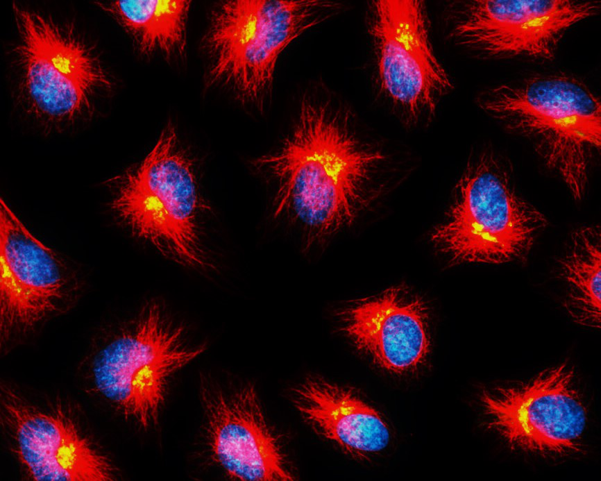 Beta-tubulin