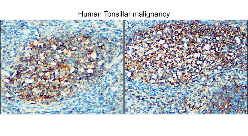 Enolase-2/ENO2 Antibody