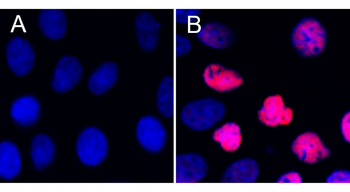 STAT3 Phospho (Tyr705) Antibody