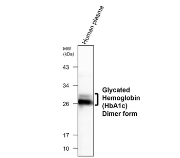 HbA1c Mouse Monoclonal Antibody