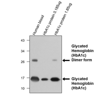HbA1c Mouse Monoclonal Antibody
