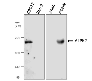 ALPK2 Rabbit Polyclonal Antibody