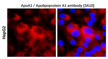 ApoA1 Mouse Monoclonal Antibody