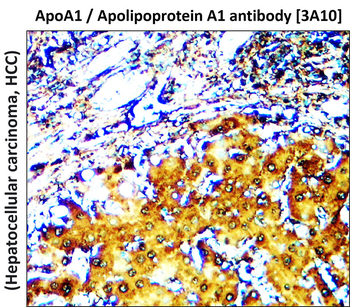 ApoA1 Mouse Monoclonal Antibody