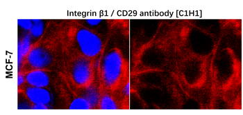 Integrin β1 Mouse Monoclonal Antibody