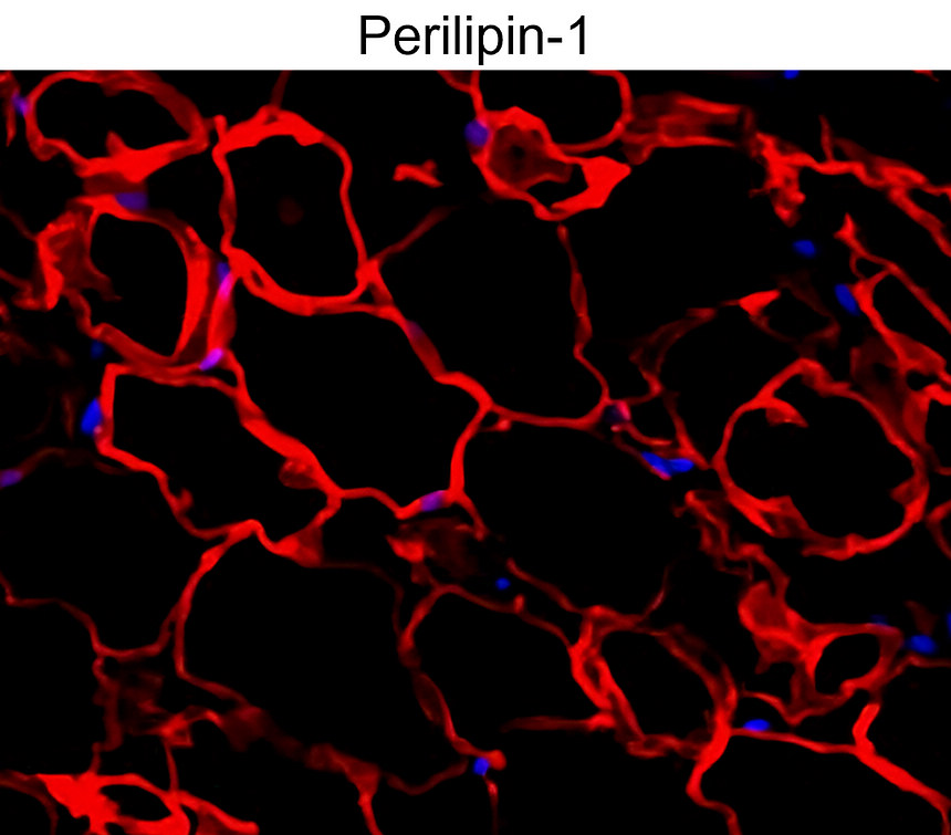 Perilipin-1 Antibody