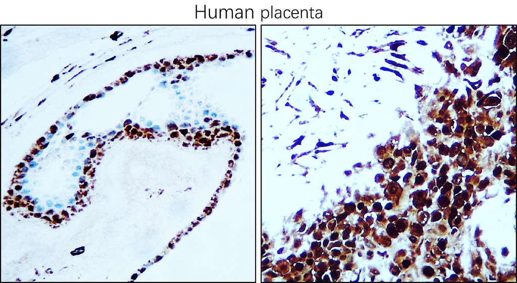 PCNA