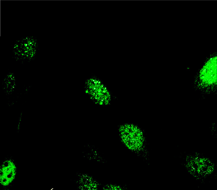 PCNA