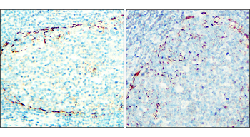 NCAM-L1 Mouse Monoclonal Antibody