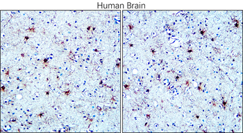 S100B Rabbit Polyclonal Antibody