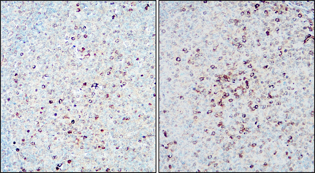 KI-67 Antibody