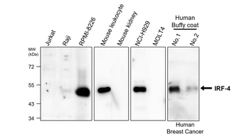 IRF4 Rabbit Polyclonal Antibody