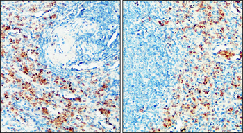 IRF4 Rabbit Polyclonal Antibody