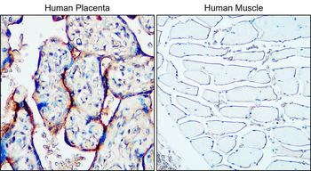 MUC1 Rabbit Polyclonal Antibody