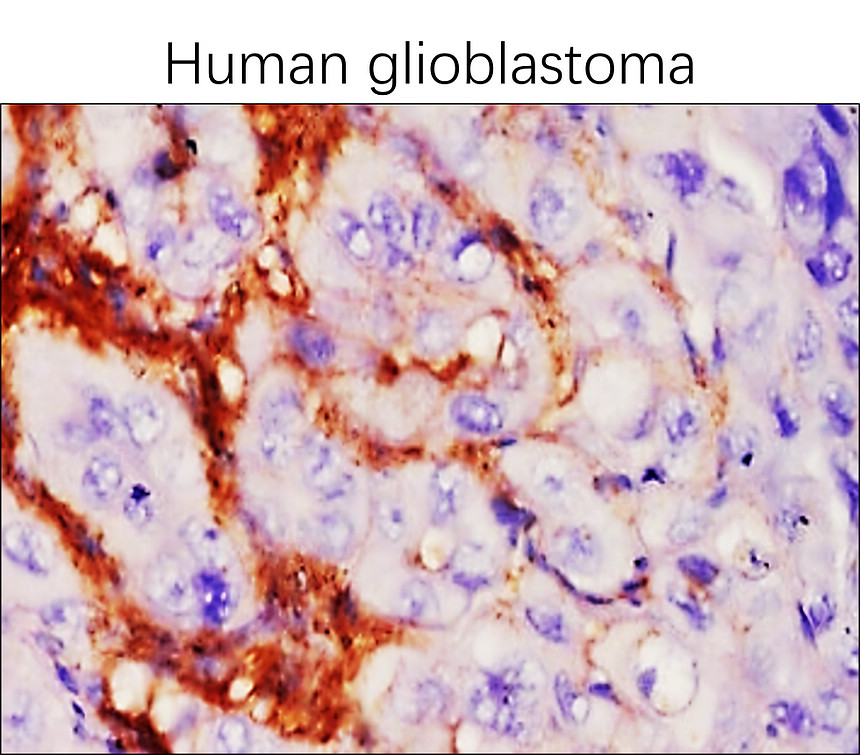 EGFR vIII antibody monoclonal antibody [23H]