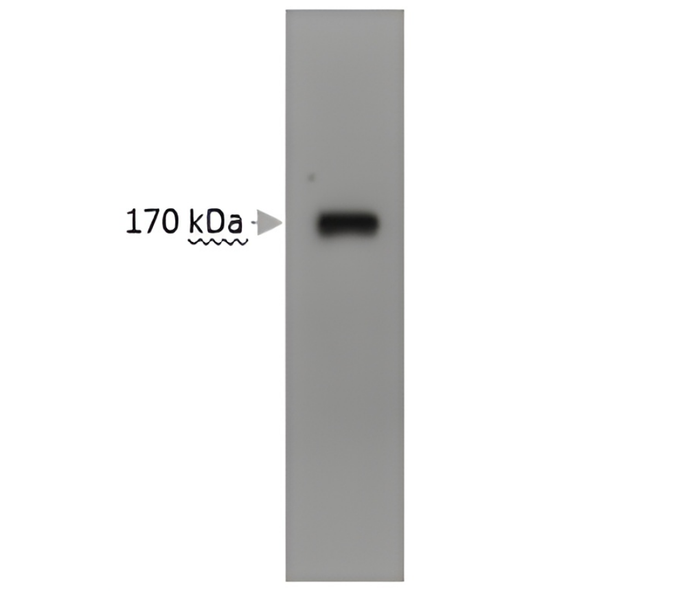 EGFR antibody monoclonal antibody [23G]