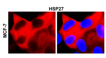 HSP27 Mouse Monoclonal Antibody