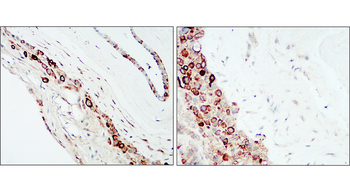 Collagen IV /COL4A1 Antibody